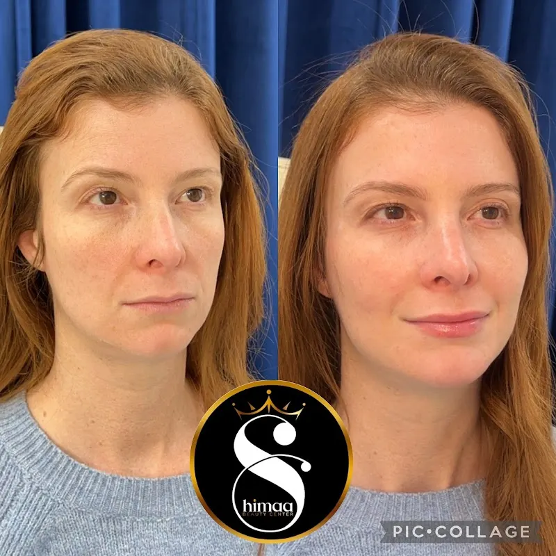 Shimaa Beauty Center Arlington — Medical spa in Arlington